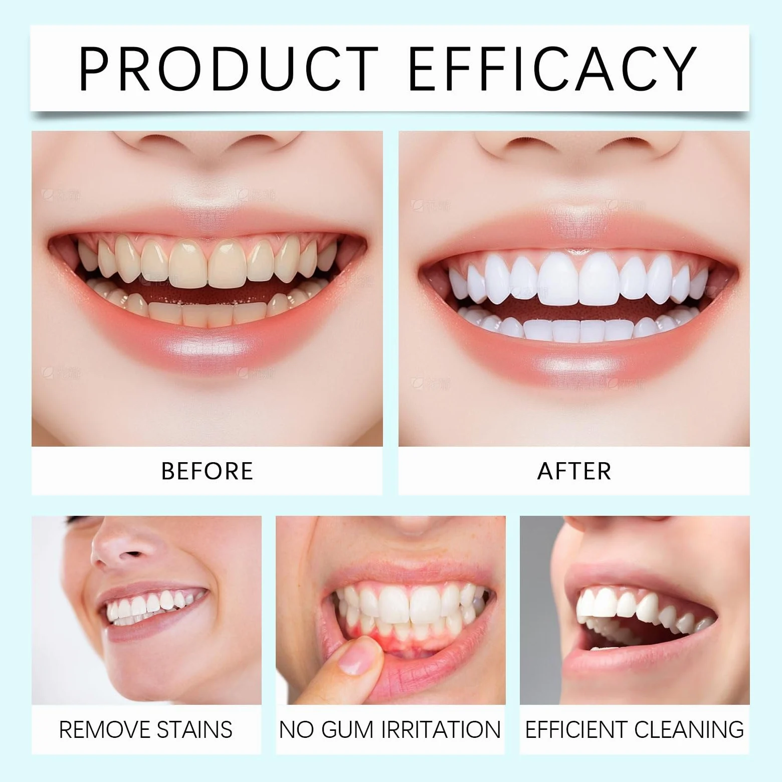 Niacinamide Dentifricio sbiancante per adulti, dentifricio sbiancante radiante, senza fluoro per denti sensibili, alito fresco, rimuove lo scolorimento dei denti. (5 pezzi)